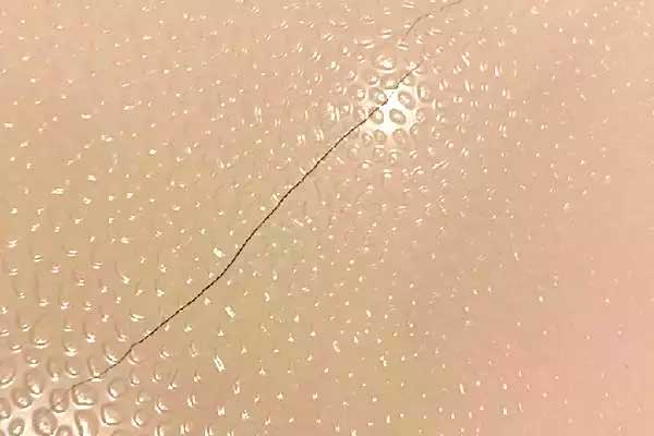 Устранение трещин